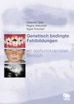 Genetisch bedingte Fehlbildungen im orofaziokranialen Bereich