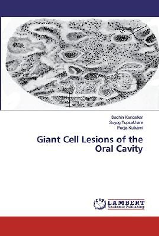 Giant Cell Lesions of the Oral Cavity