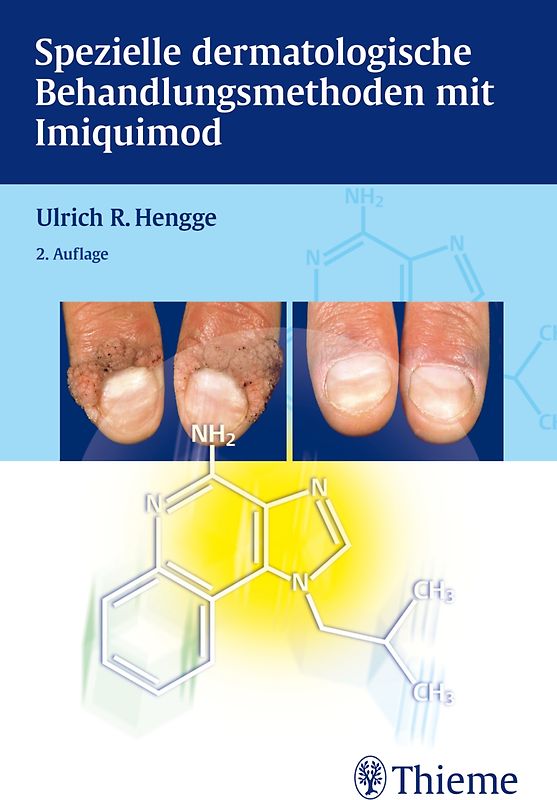 Spezielle dermatologische Behandlungsoptionen mit Imiquimod