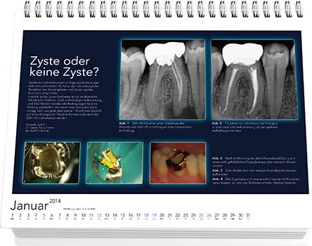 Endodontie-Kalender 2014