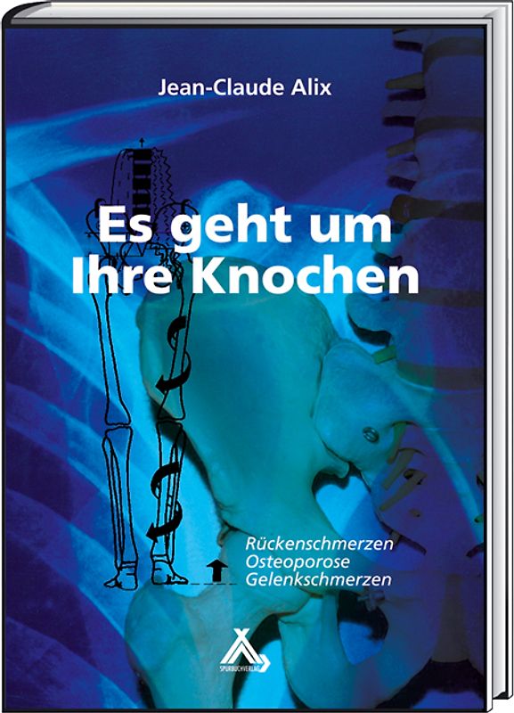 Es geht um Ihre Knochen