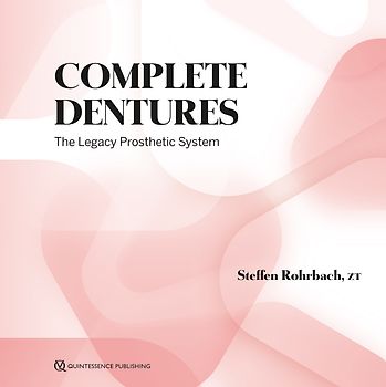 Complete Dentures