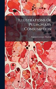 Illustrations Of Pulmonary Consumption