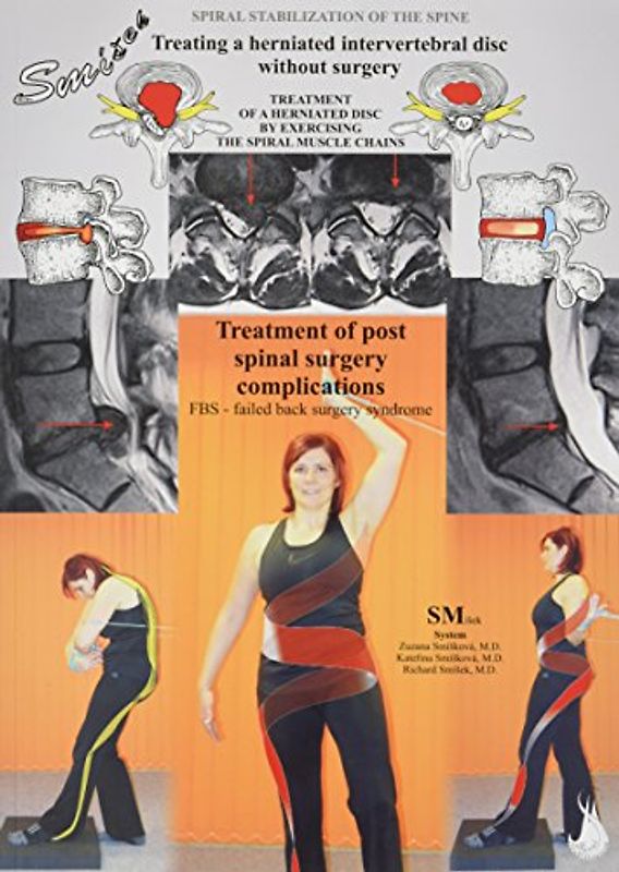 Treating a herniated intervertebral disc without surgery