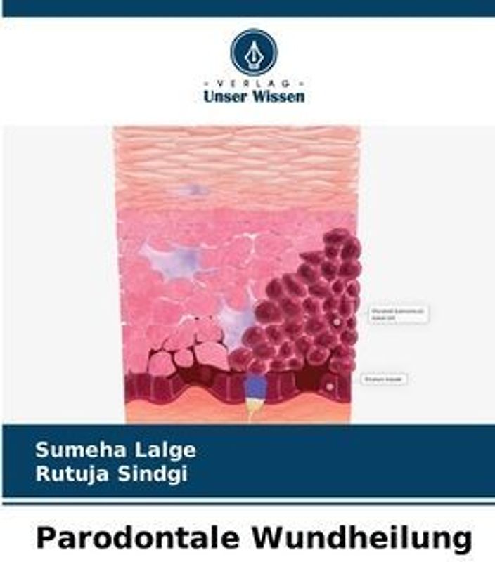 Parodontale Wundheilung