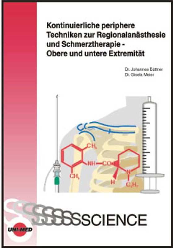 Kontinuierliche periphere Techniken zur Regionalanästhesie und Schmerztherapie - Obere und untere Extremität