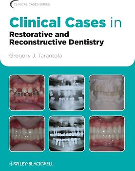 Clinical Cases in Restorative and Reconstructive Dentistry