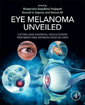 Eye Melanoma Unveiled