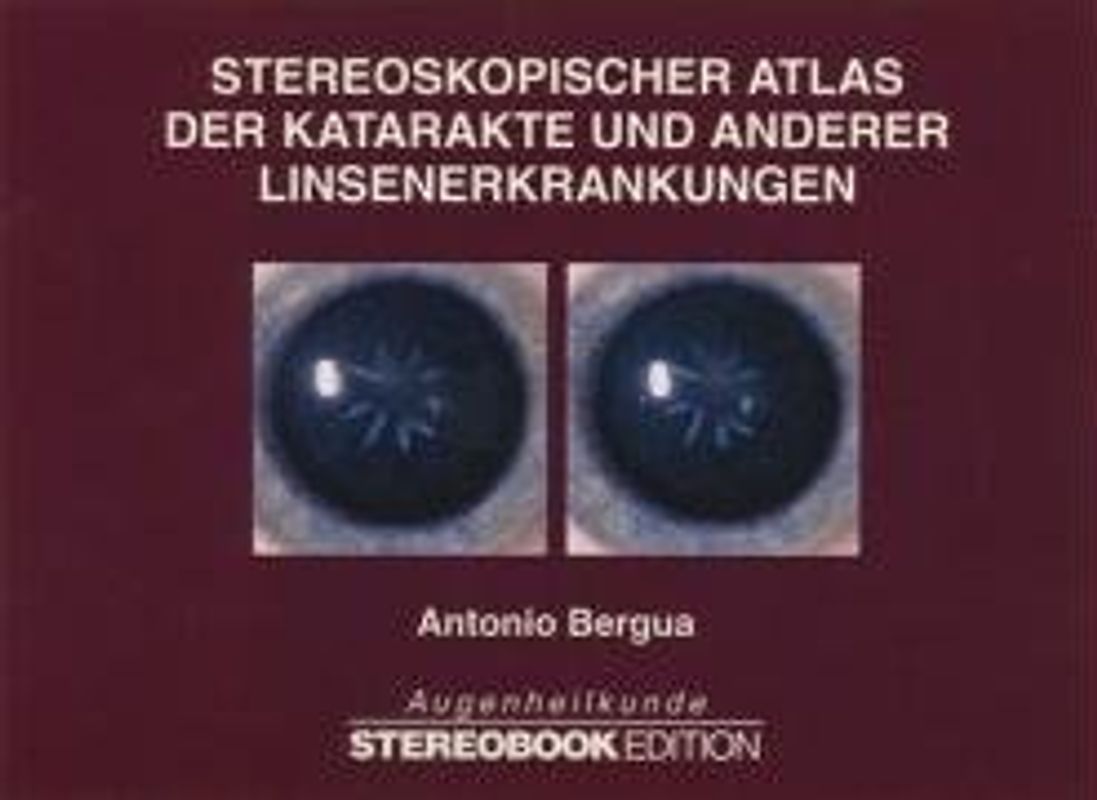 Stereoskopischer Atlas der Katarakte und anderer Linsenerkrankungen