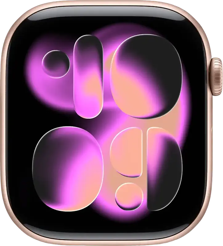 Apple Watch Series 11 46 mm Boîtier aluminium or rose [Wi-Fi]