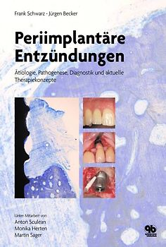 Periimplantäre Entzündungen