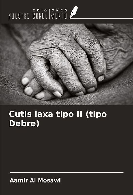 Cutis laxa tipo II (tipo Debre)