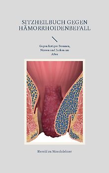 Sitzheilbuch gegen Hämorrhoidenbefall