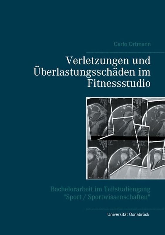 Verletzungen und Überlastungsschäden im Fitnessstudio