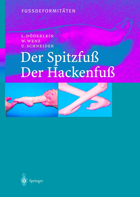 Fussdeformitäten