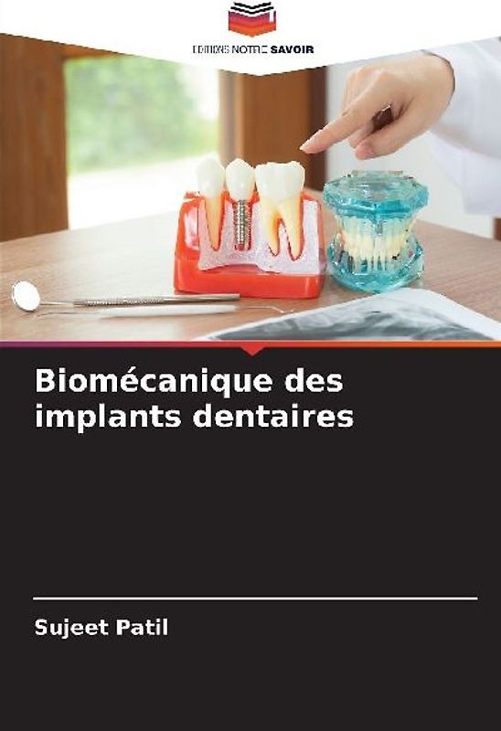 Biomécanique des implants dentaires