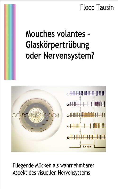 Mouches volantes - Glaskörpertrübung oder Nervensystem?