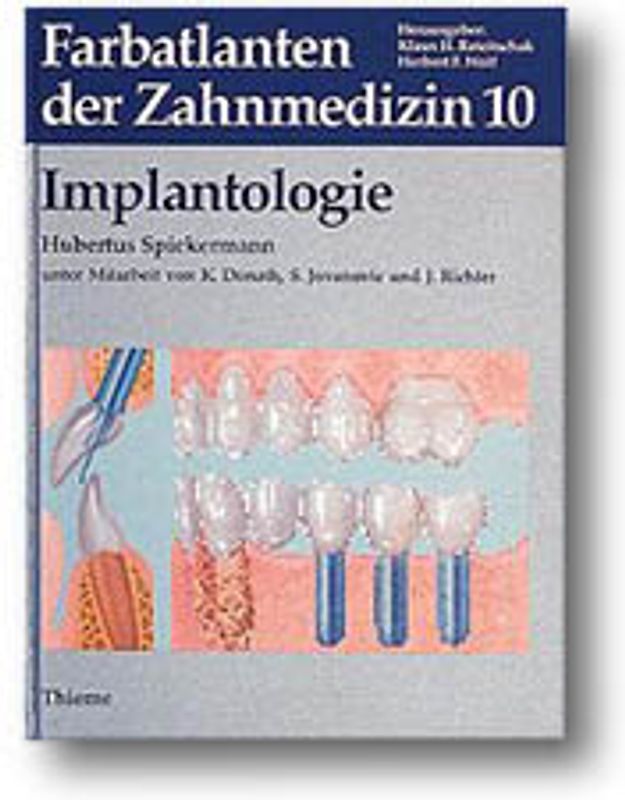Implantologie