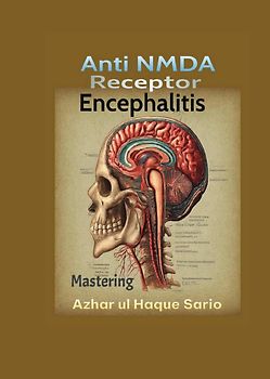 Mastering Anti NMDA Receptor Encephalitis