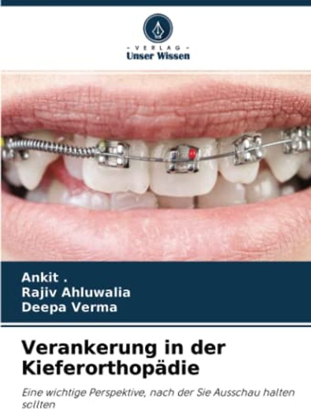 Verankerung in der Kieferorthopädie: Eine wichtige Perspektive, nach der Sie Ausschau halten sollten