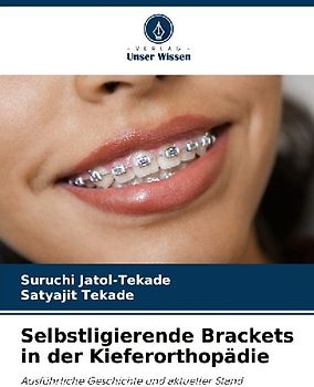 Selbstligierende Brackets in der Kieferorthopädie