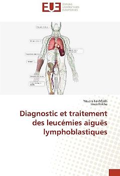 Diagnostic et traitement des leucémies aiguës lymphoblastiques