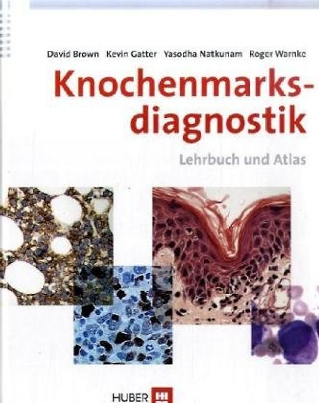 Knochenmarksdiagnostik