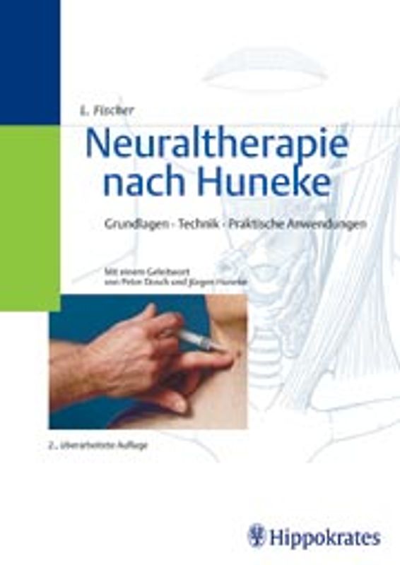 Neuraltherapie nach Huneke