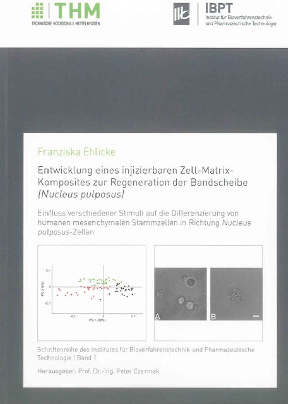 Entwicklung eines injizierbaren Zell-Matrix-Komposites zur Regeneration der Bandscheibe (Nucleus pulposus)