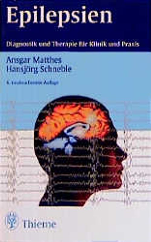 Epilepsien