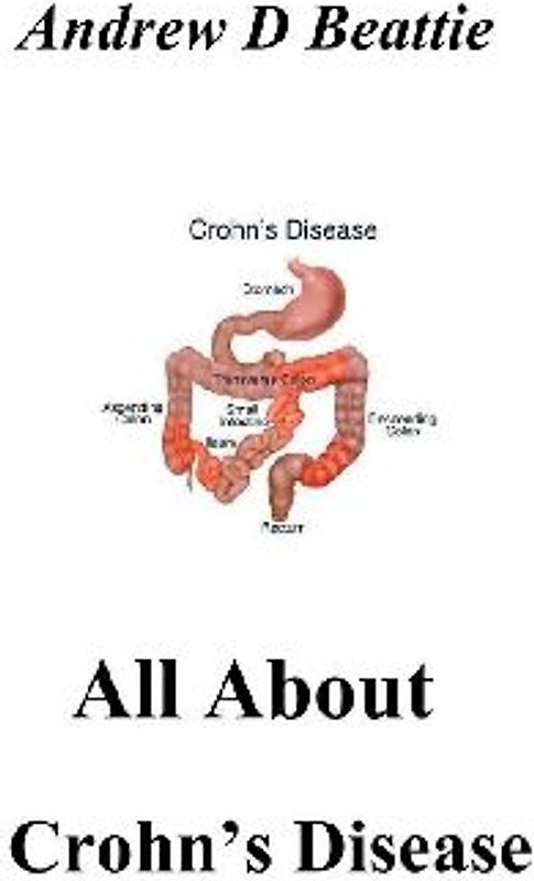 All About Crohn's Disease