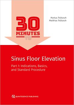 30 Minutes to Sinus Floor Elevation
