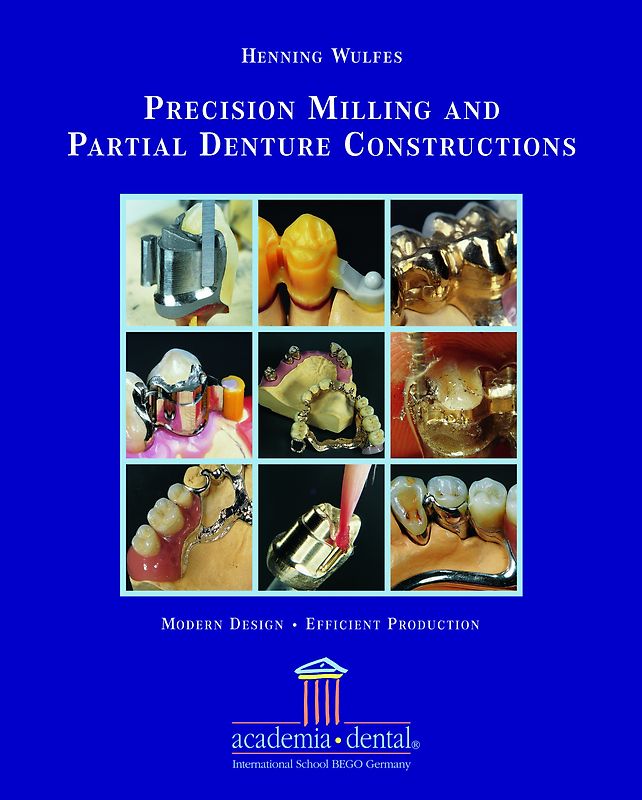 Precision Milling and Partial Denture Constructions: A Manual. Englische Ausgabe