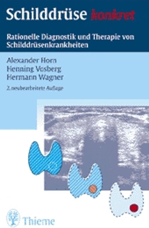 Schilddrüse konkret