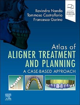 Atlas of Aligner Treatment and Planning