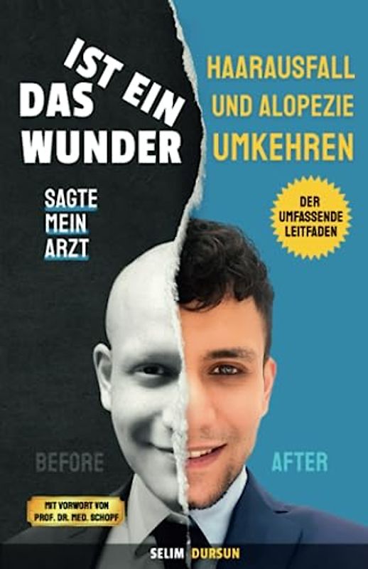 DAS IST EIN WUNDER SAGTE MEIN ARZT: HAARVERLUST UND ALOPEZIE UMKEHREN