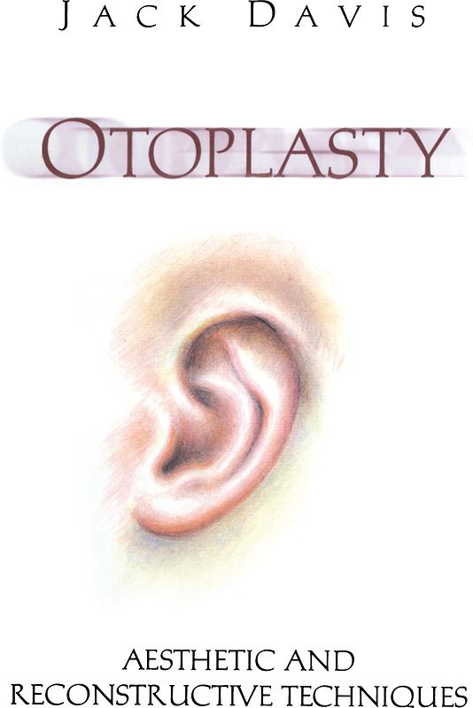 Otoplasty