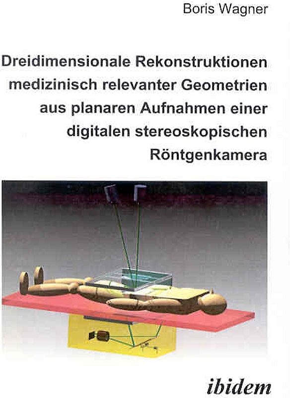 Dreidimensionale Rekonstruktionen medizinisch relevanter Geometrien aus planaren Aufnahmen einer digitalen stereoskopischen Röntgenkamera