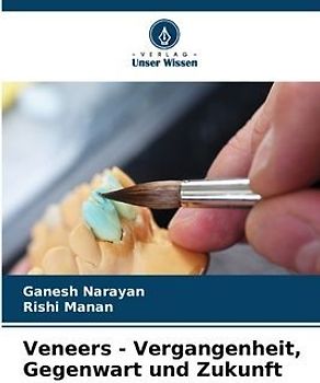 Veneers - Vergangenheit, Gegenwart und Zukunft