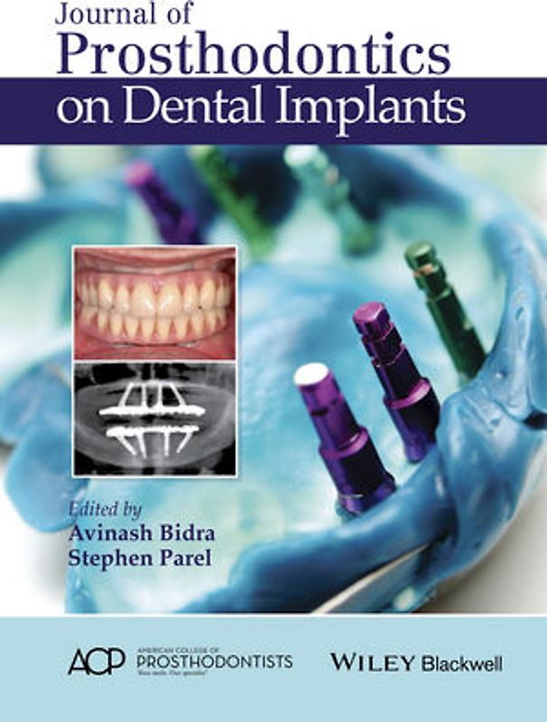 Journal of Prosthodontics on Dental Implants