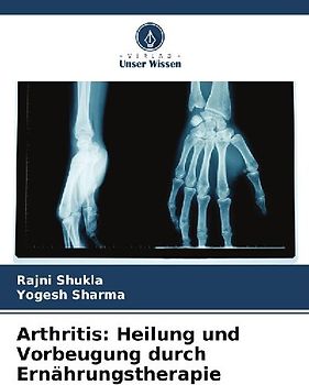 Arthritis: Heilung und Vorbeugung durch Ernährungstherapie