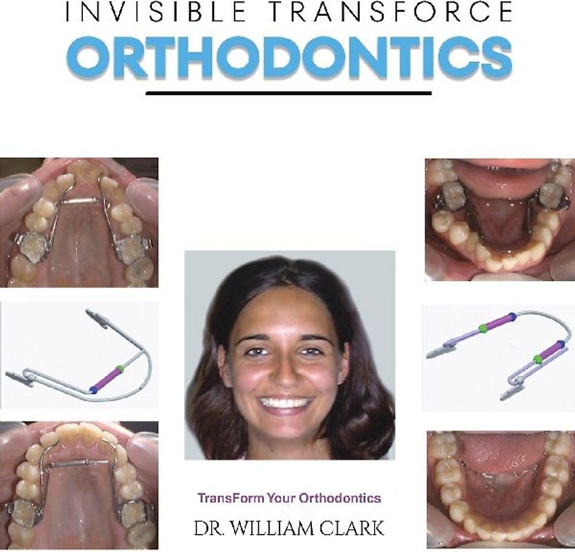 Invisible TransForce Orthodontics