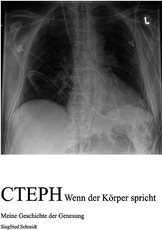 CTEPH Wenn der Körper spricht