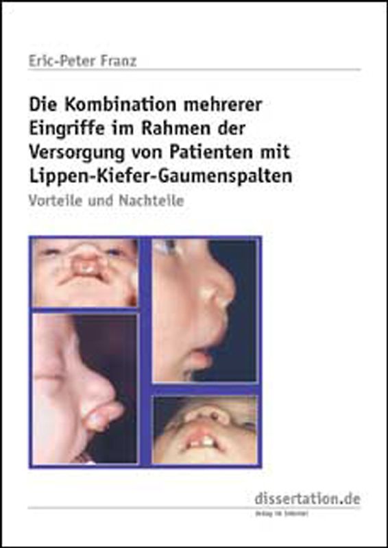 Die Kombination mehrerer Eingriffe im Rahmen der Versorgung von Patienten mit Lippen-Kiefer-Gaumenspalten