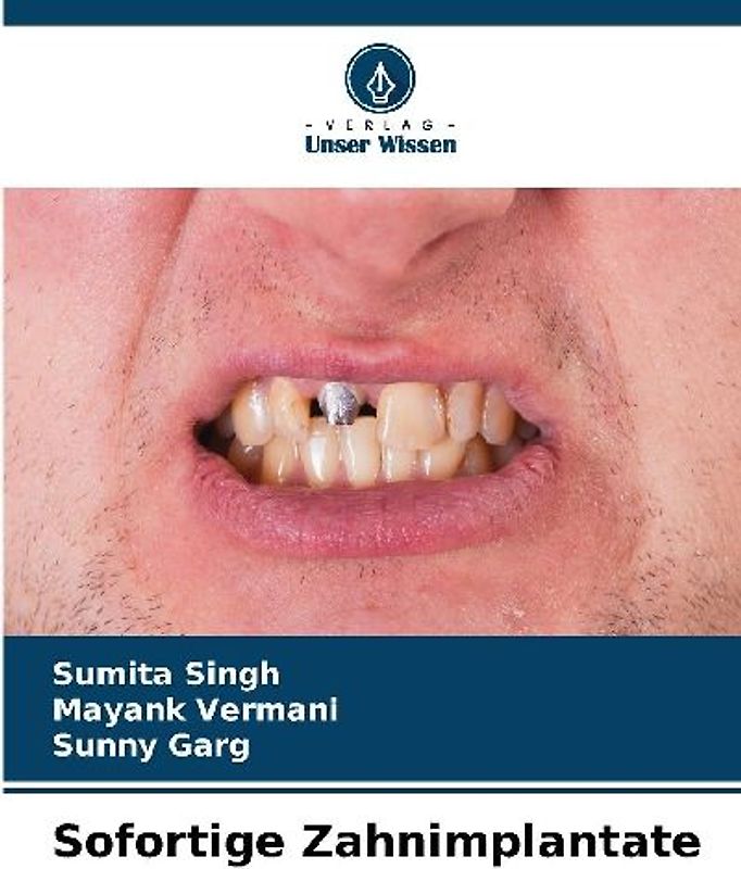 Sofortige Zahnimplantate