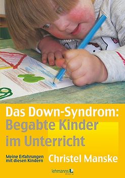 Das Down-Syndrom – Begabte Kinder im Unterricht