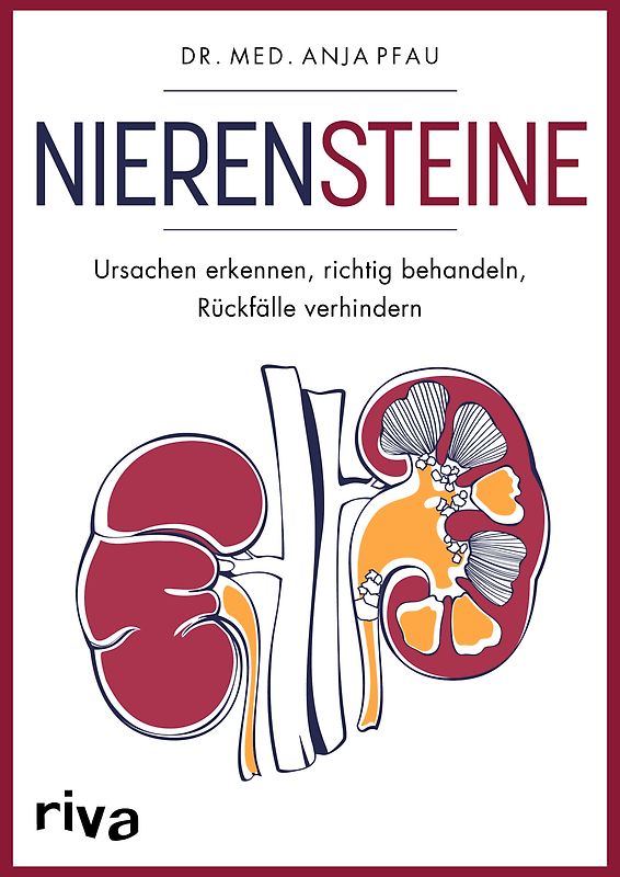 Nierensteine – Ursachen erkennen, richtig behandeln, Rückfälle verhindern