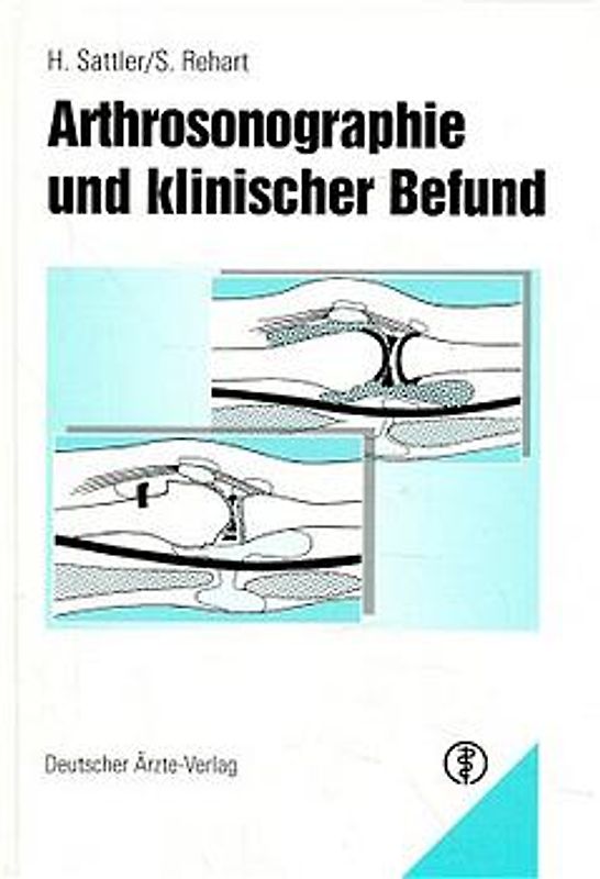 Arthrosonographie und klinischer Befund