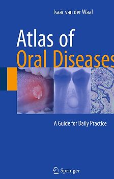 Atlas of Oral Diseases