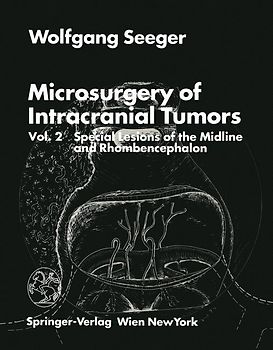 Microsurgery of Intracranial Tumors